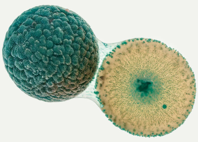 Muse Stem Cells the future of Stem Cell Therapy now in Mexico
