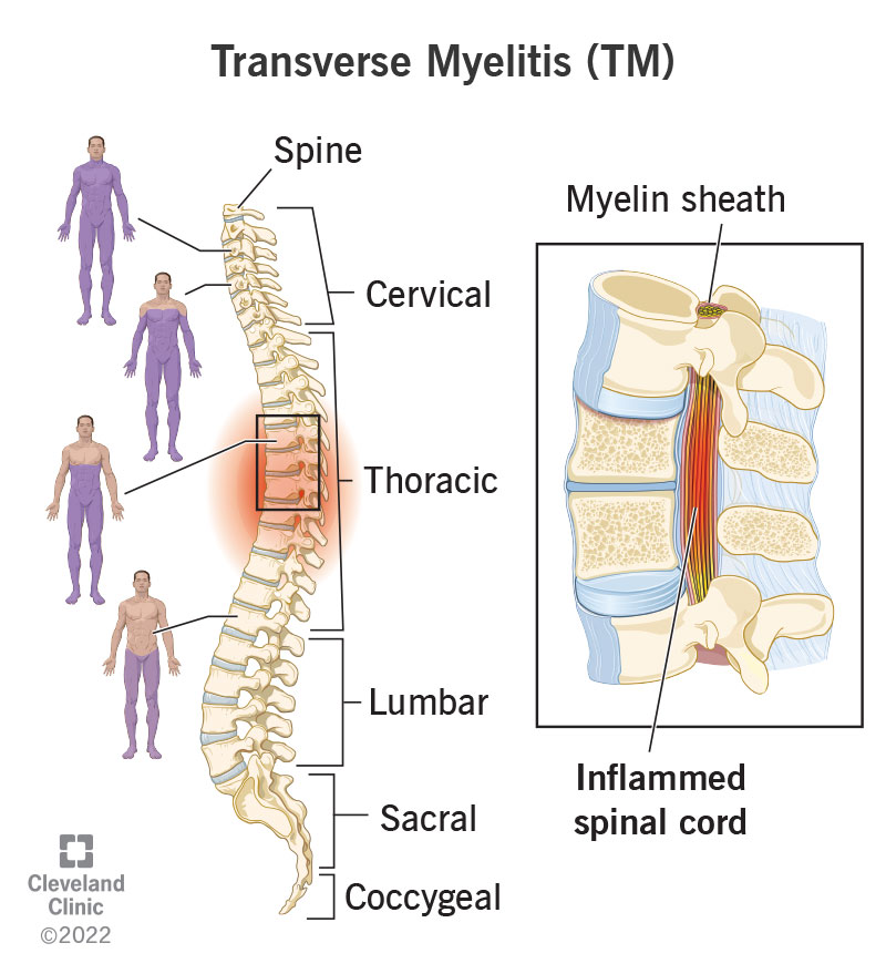 stem cell therapy in mexico for chronic pain